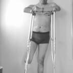 amputwink OnlyFans Leaks 

 picture 1