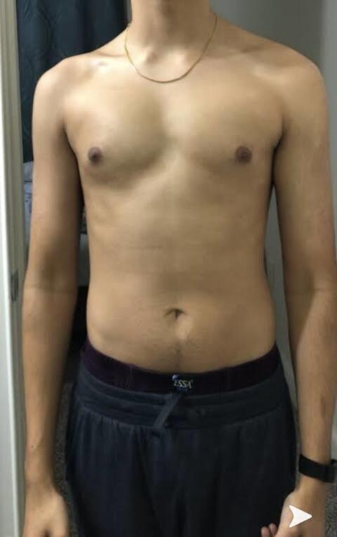asshitot (dikadik) OnlyFans content 

 picture 2