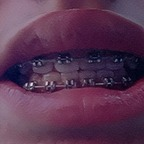 bracesfetish OnlyFans Leaked (33 Photos and 0 Videos) 

 picture 1