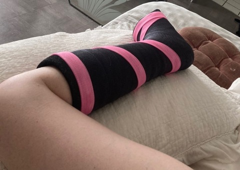 Download brokenankle93 OnlyFans content for free 

 picture 2
