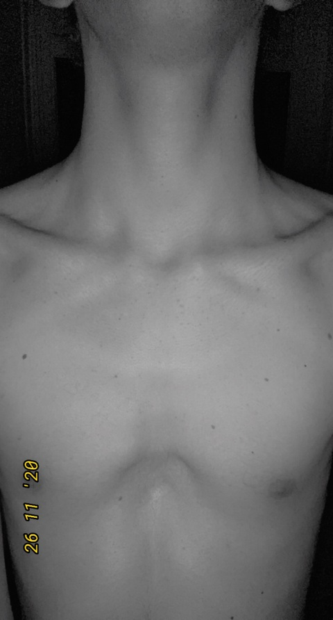 busteddlipz OnlyFans Leak 

 picture 2