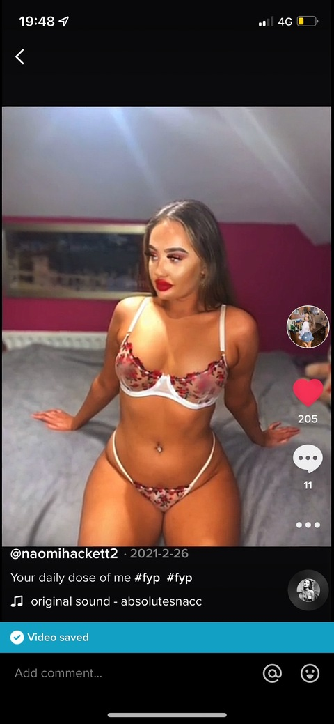 candyfreexo (Candyfreex) OnlyFans Leaked Pictures and Videos 

 picture 2