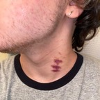 drewtrashpanda OnlyFans Leaks (536 Photos and 64 Videos) 

 picture 1
