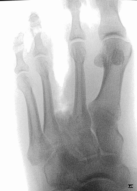k-4toed_foot OnlyFans Leaked (1 Photos and 0 Videos) 

 picture 2