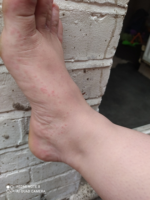 Onlyfans free content lucyfeetfetish 

 picture 2