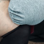 Onlyfans free notoesnoleftleg 

 picture 1
