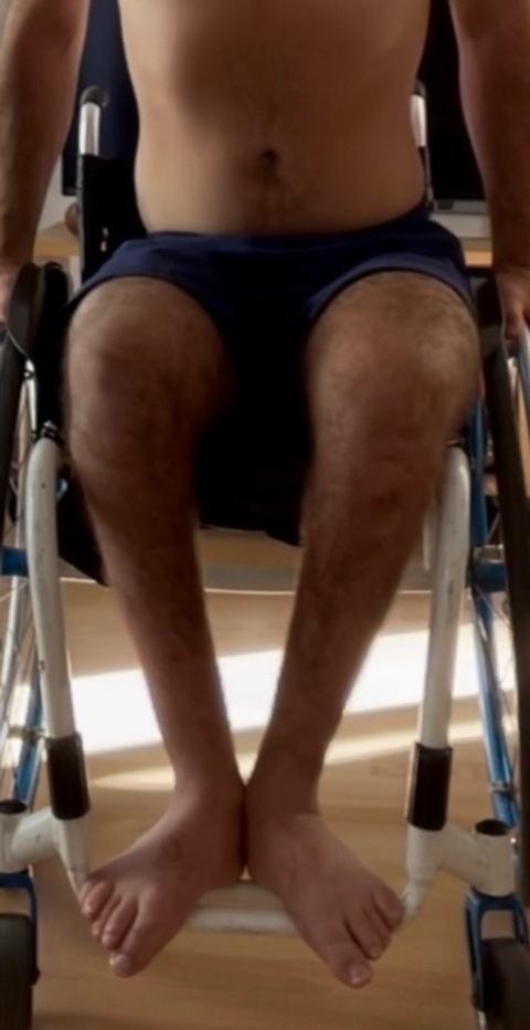 paraplegicboy OnlyFans Leak 

 picture 2