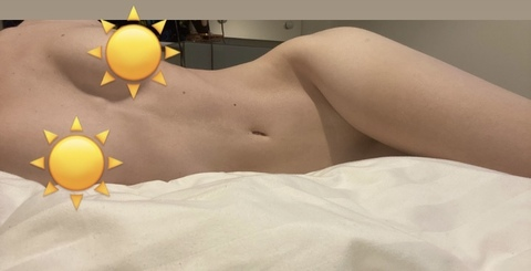 Download skinnymnx OnlyFans content free 

 picture 2
