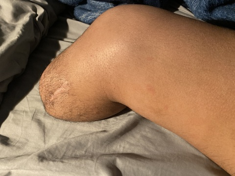 View strongamputee OnlyFans videos and photos for free 

 picture 2