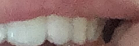 teddysuc leaked gallery photo 2