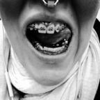 View teethshow (teethshow) OnlyFans 1333 Photos and 518 Videos gallery 

 picture 1